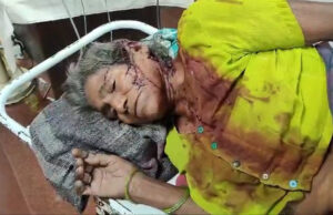 बुजुर्ग महिला पर जानलेवा हमला