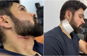 शूटिंग के दौरान घायल हुए इमरान हाशमी